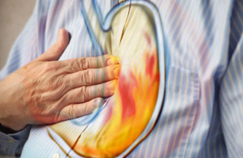 10 Home Remedies for Heartburn and Acid Reflux